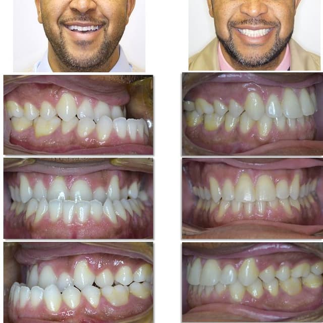 The Orthospaceship- Hakim Orthodontics photo