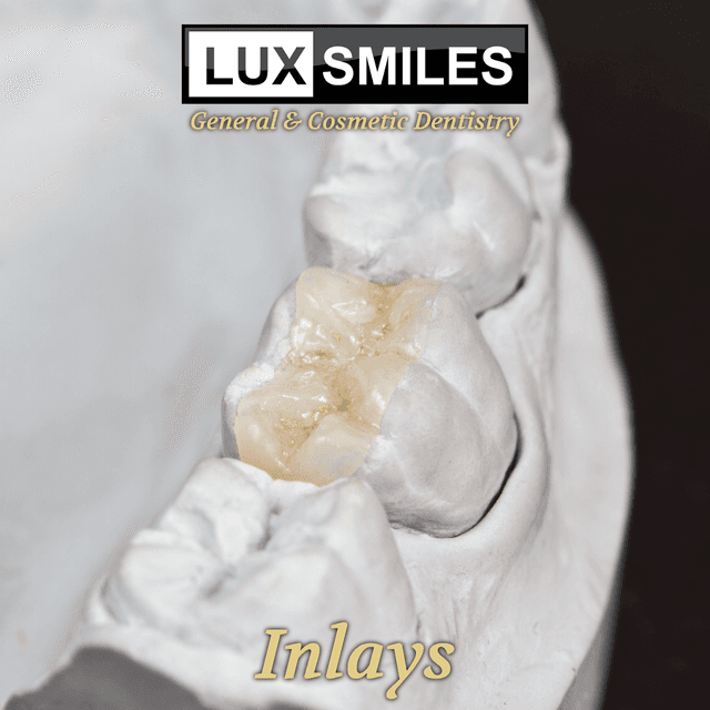 Lux Smiles photo