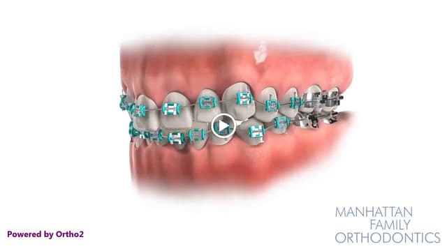 Manhattan Family Orthodontics-Uptown photo