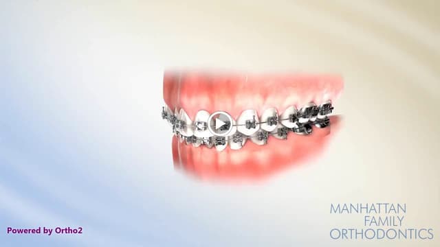 Manhattan Family Orthodontics-Uptown photo