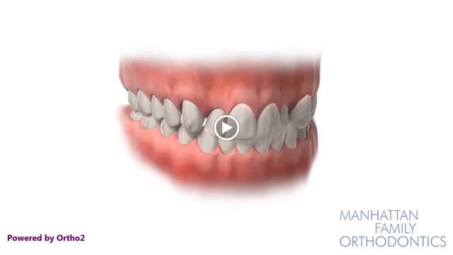 Manhattan Family Orthodontics-Uptown photo