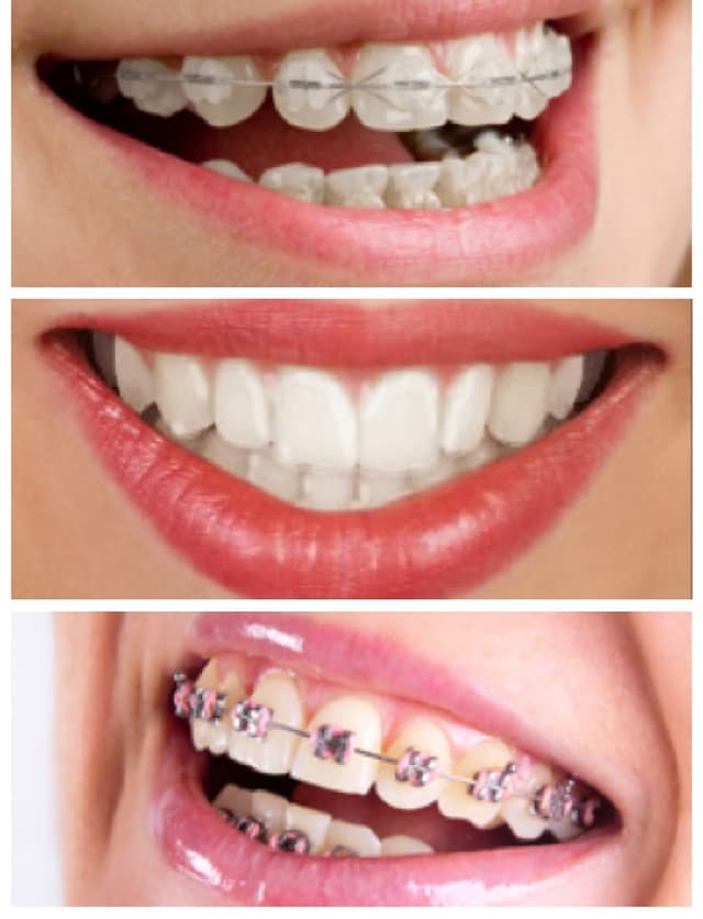 Straight Finish Orthodontics photo