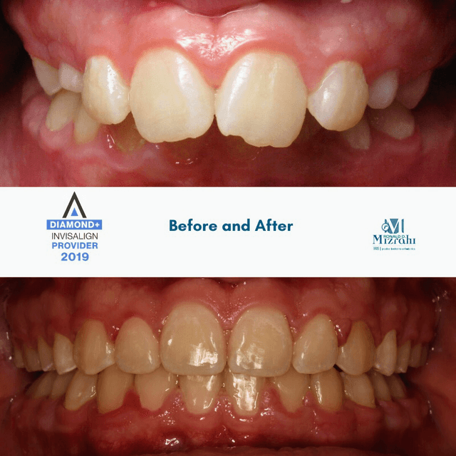 Mizrahi Orthodontics photo