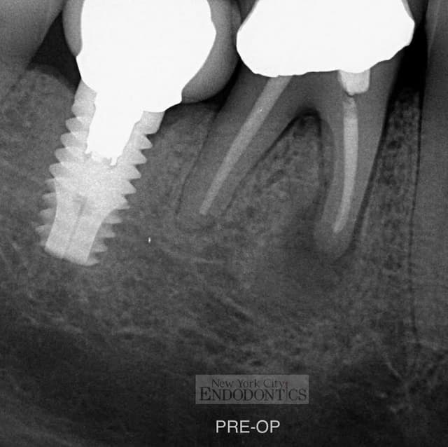 New York City Endodontics photo