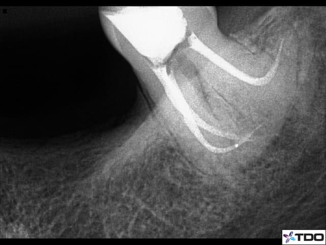 New York City Endodontics photo